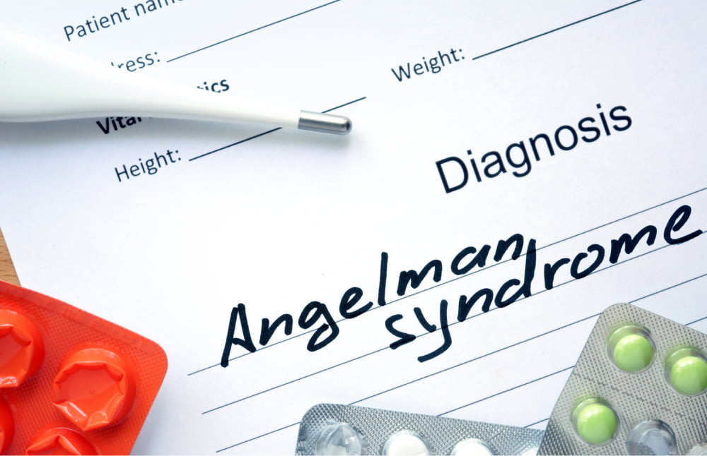 Angelman syndrome &#8211; Signs, causes, and management options