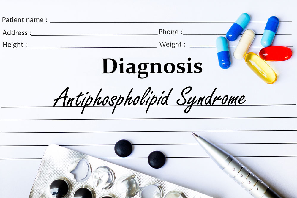 Antiphospholipid syndrome &#8211; Symptoms, diagnosis, and lifestyle changes