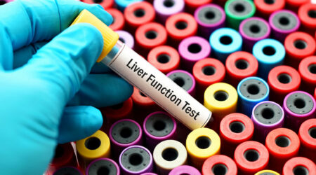 Purpose, types, and procedure of liver function tests