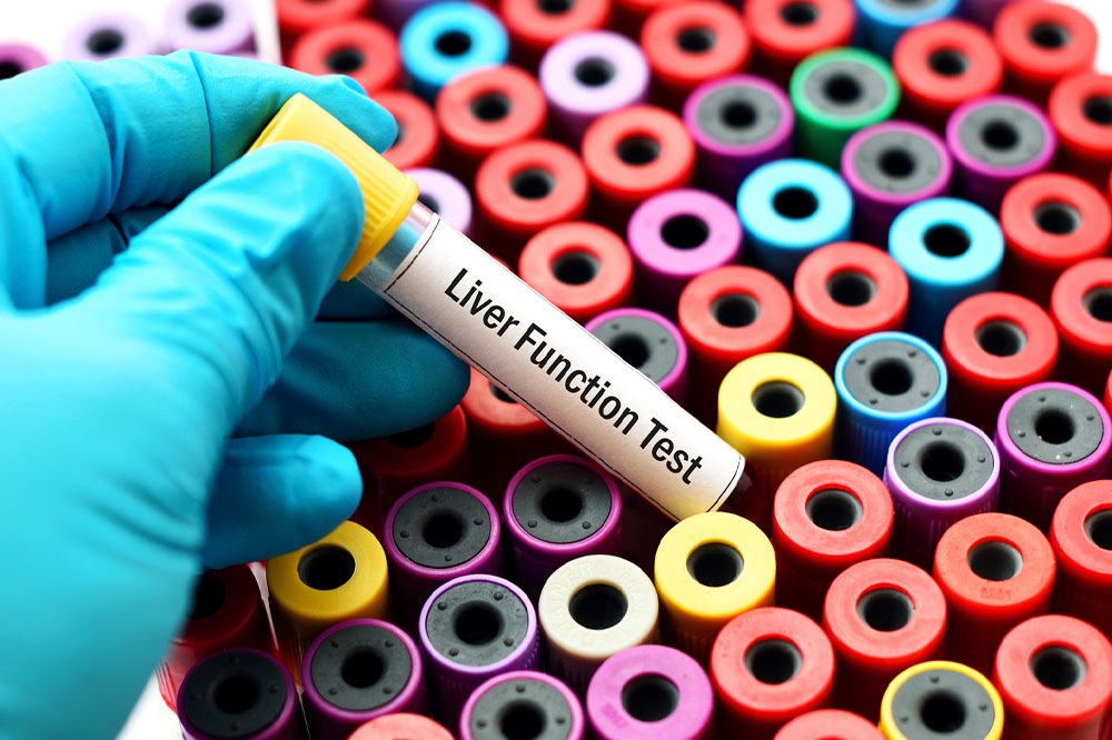 Purpose, types, and procedure of liver function tests