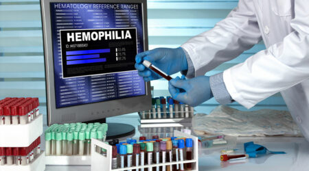 Signs, causes, and management of hemophilia