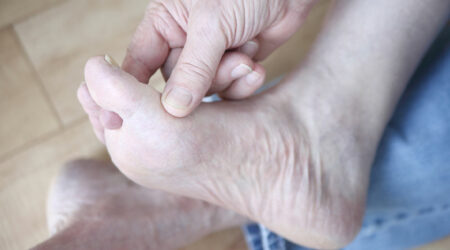 Symptoms and care for swollen ankles