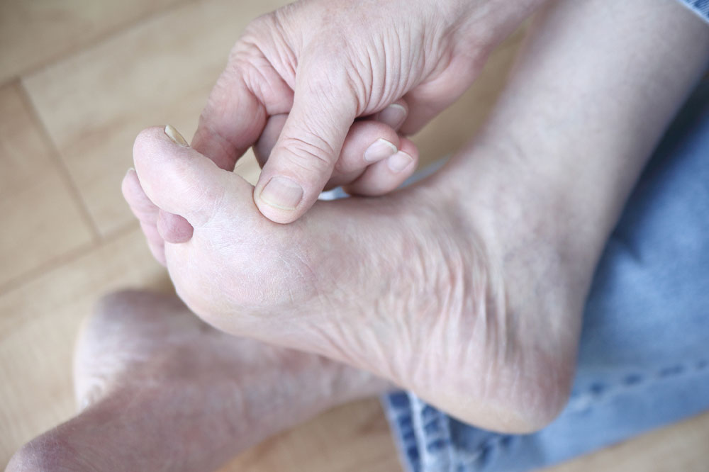 Symptoms and care for swollen ankles