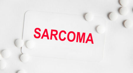 Synovial sarcoma &#8211; Its causes, symptoms, and management