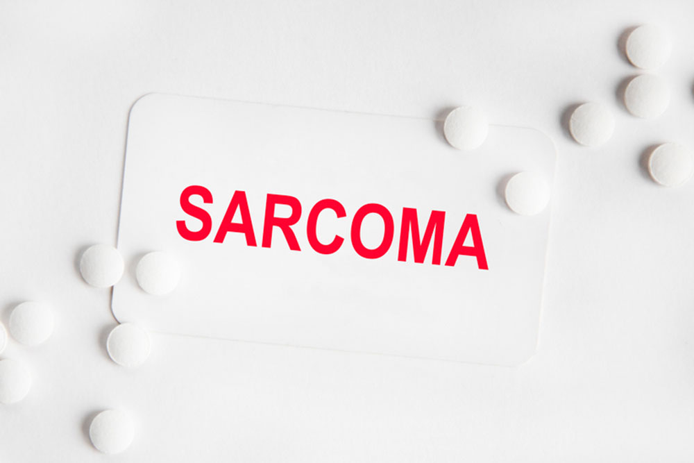 Synovial sarcoma &#8211; Its causes, symptoms, and management