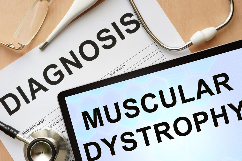 Symptoms, causes, and management for muscular dystrophy